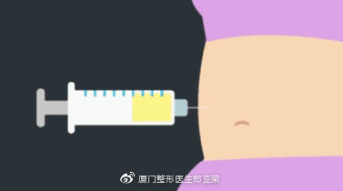 假体隆胸和自体隆胸的各自优势,假体隆胸和脂肪隆胸怎么选