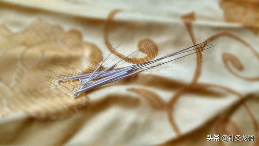 学习中医针灸入门必读书籍,学习中医针灸要学哪些课程