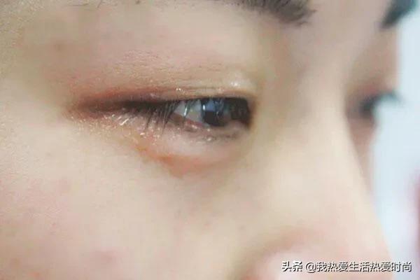 眼皮跳怎么消除不好的运势,眼皮跳和运气有关这科学吗