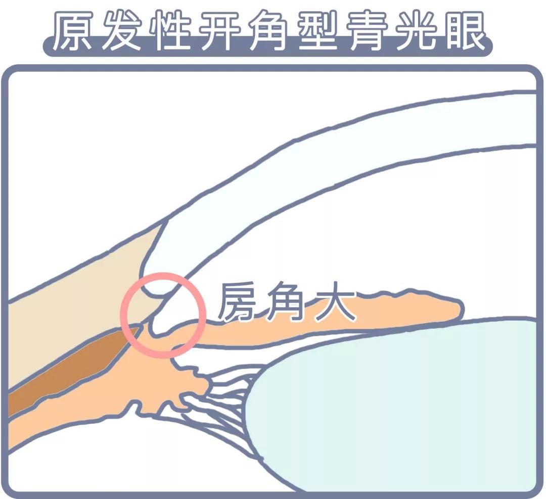 熬夜恶心想吐最快的缓解方法,上夜班熬夜想吐恶心怎么回事