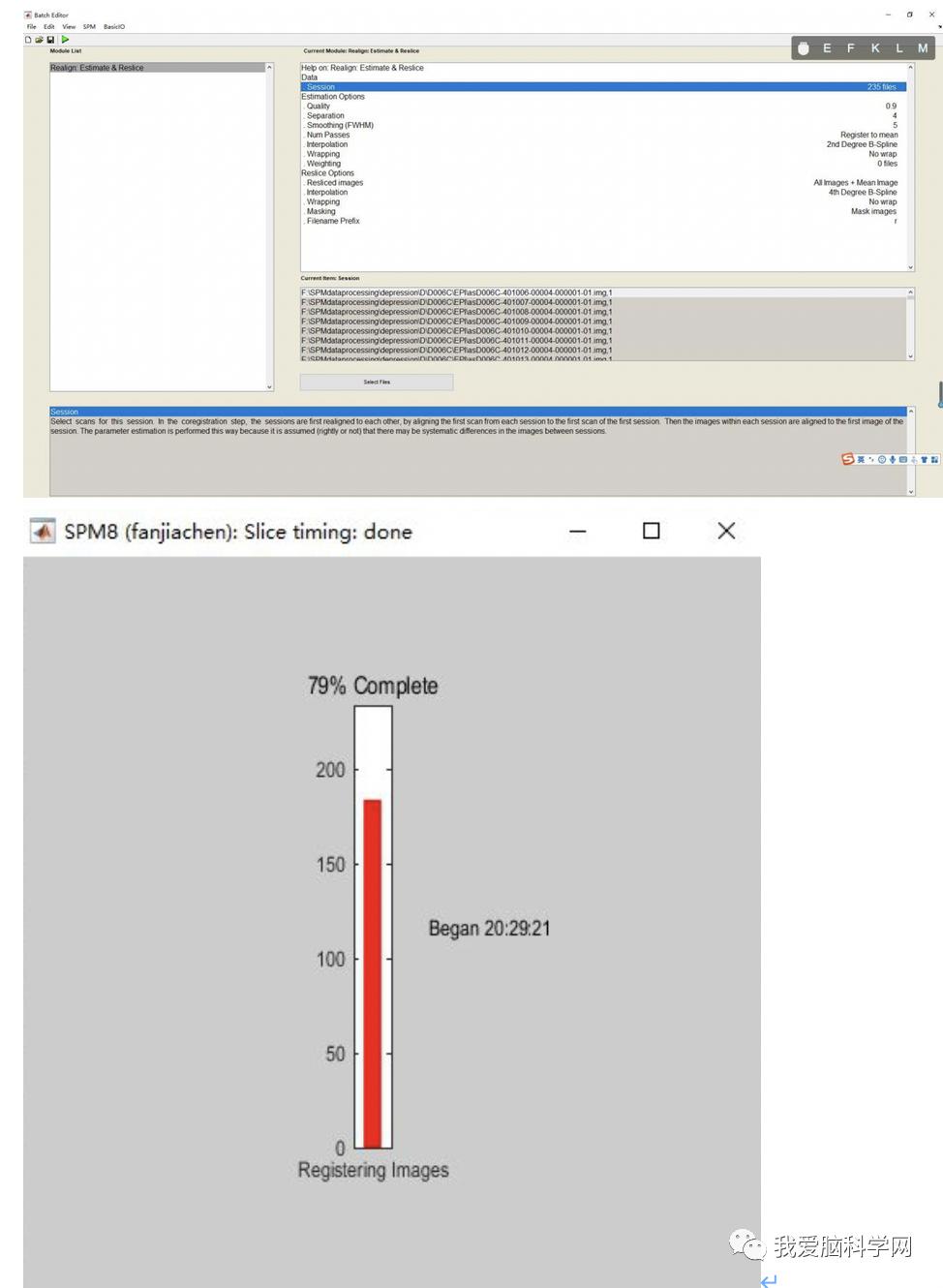 脑功能报告解读,颅脑mri信号讲解视频教程