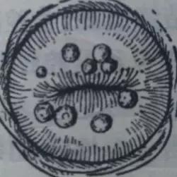 宫颈囊肿17x15mm要治疗吗,宫颈囊肿0.8*0.7需要治疗吗