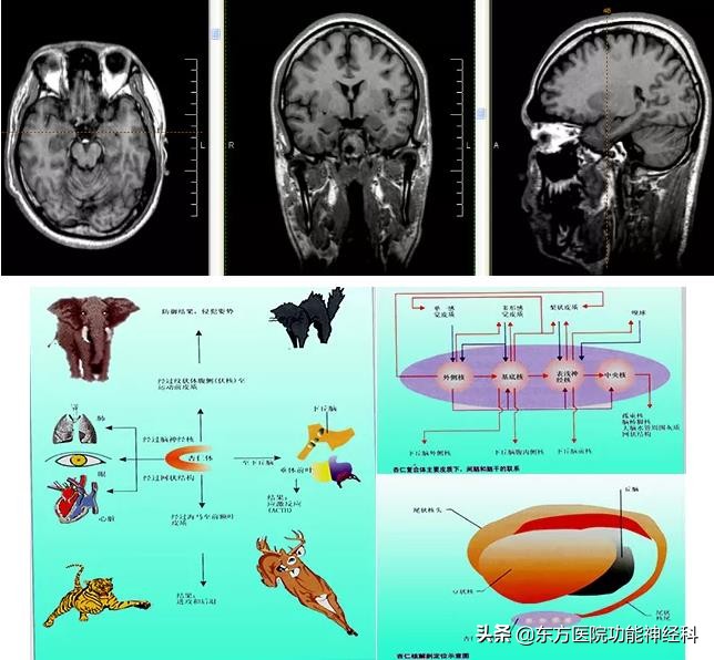 精神病人的前世,精神科药物的前世今生