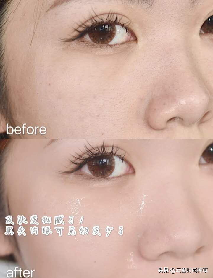 洗面奶张歆艺,张歆艺推荐护肤套装