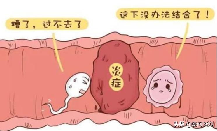 妇科炎症要注意哪些呢,妇科炎症需要注意哪些事项