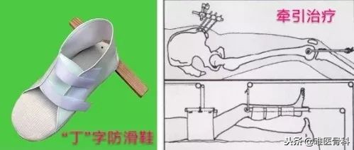 老年人骨折最怕什么病,老年人最常见的骨折有哪些