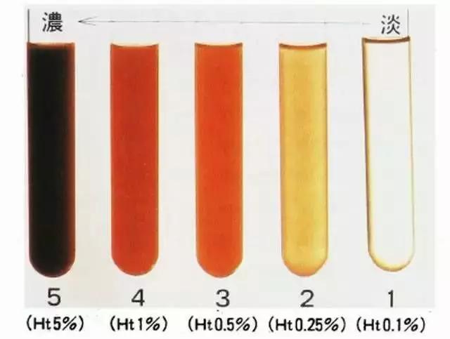 尿血是不是有病,肾病尿血危及生命吗