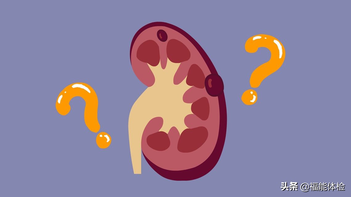 体检发现肾囊肿不要怕,体检肾囊肿要注意什么