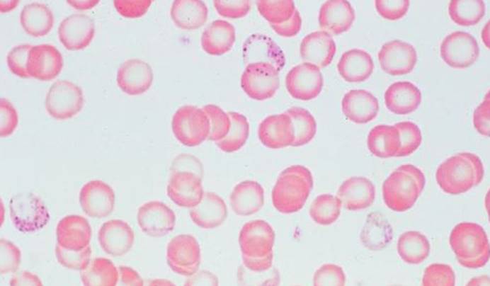 人类接触核辐射会怎么样,人接触铅对身体有害吗