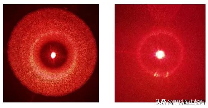 红光治疗仪使用注意事项！近视防控纯干货分享