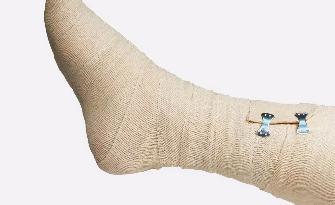 骨科大夫带您了解：神奇的“石膏”