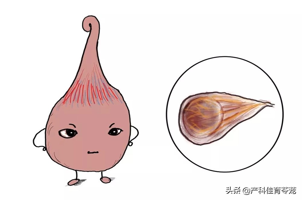 前置血管容易断裂吗,前置血管破裂对母体有什么伤害