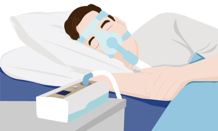 重度打鼾最新最佳治疗方法,轻度打鼾要不要呼吸机