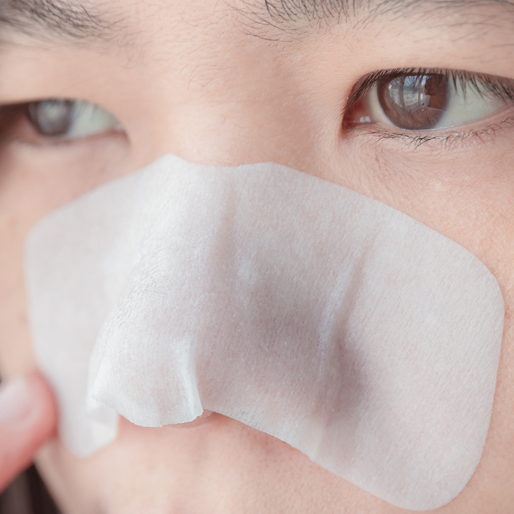 鼻贴能去闭口吗,鼻贴真的能去黑头吗