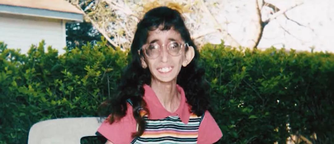 世界上最丑陋的女孩儿,世界最丑的女孩