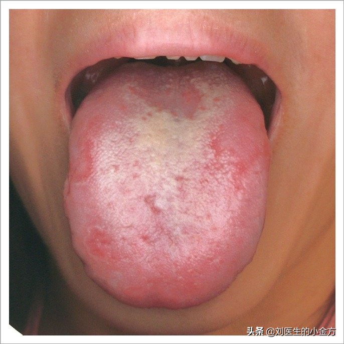 中医舌诊对照表100例,舌诊辨九大体质