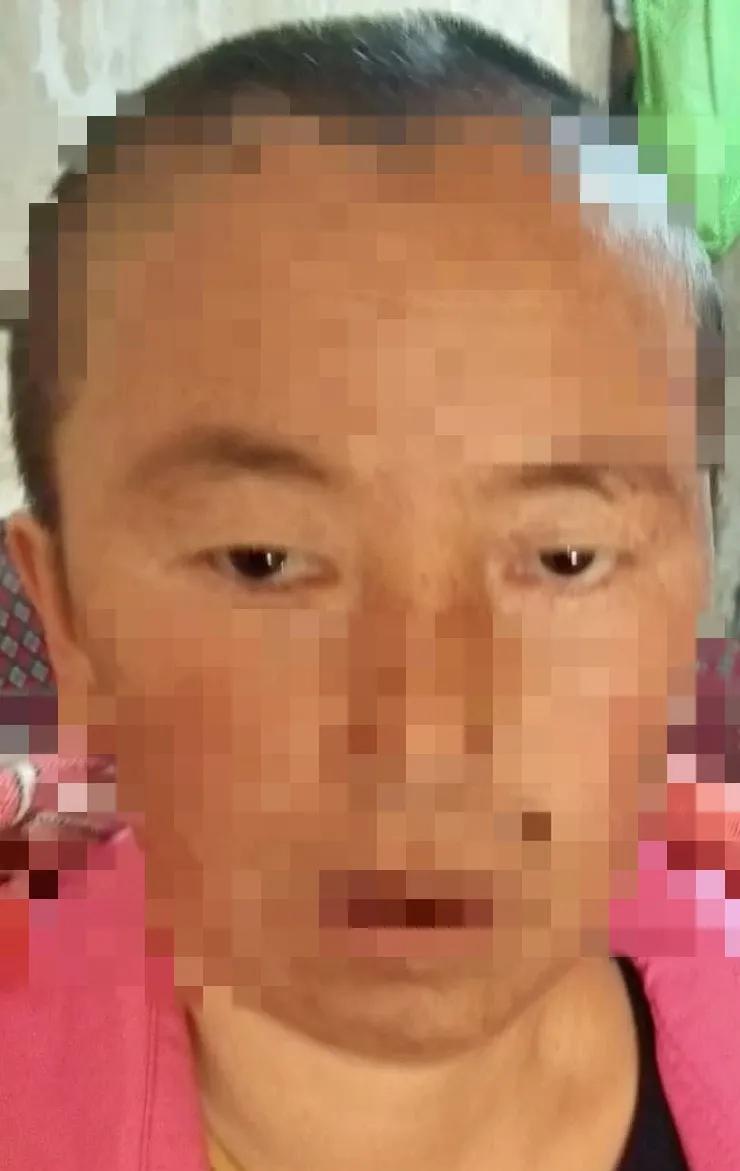 见微知著,内镜显神通