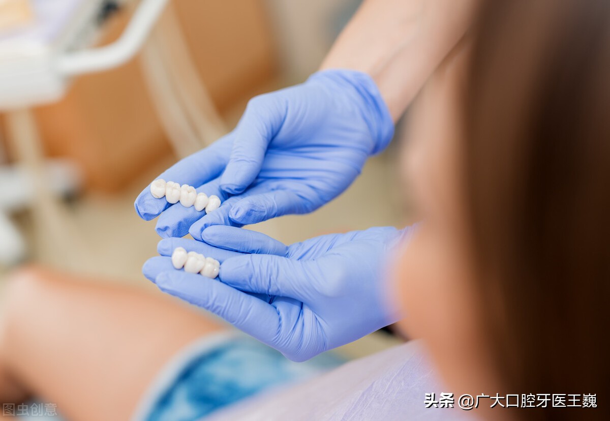 全瓷牙和烤瓷牙哪一个比较实用,全瓷牙和烤瓷牙有什么区别哪种好