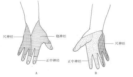 颈椎手麻手指肿胀胳膊麻怎么缓解,手腕颈椎疼痛怎么治