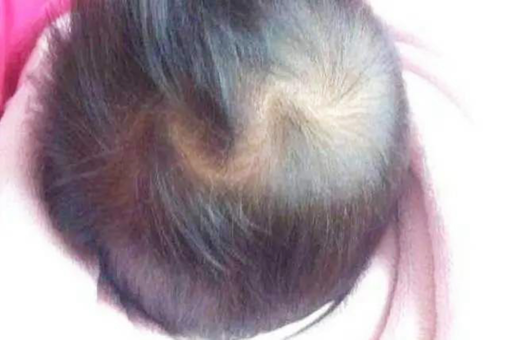 头旋决定性格和智商,头旋决定孩子的性格和智商