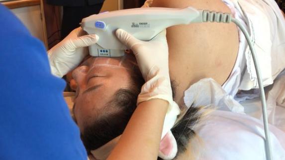 褐青色斑和雀斑哪个容易治疗,色沉和雀斑适合做什么医美项目