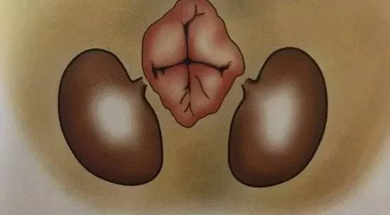 猫咪肛腺发炎怎么弄,猫咪肛腺肿怎么处理