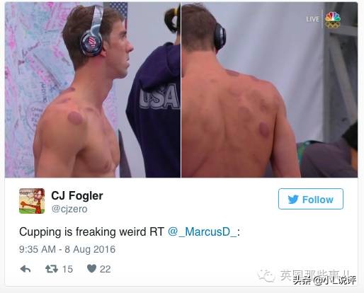 来自东方的神秘力量，让老外痴迷的拔火罐和蚊帐