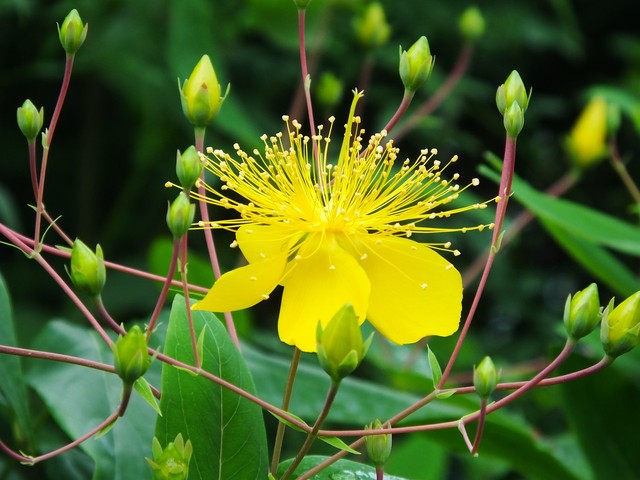 黄煌教授经方50例,黄煌经方治疗股骨头坏死