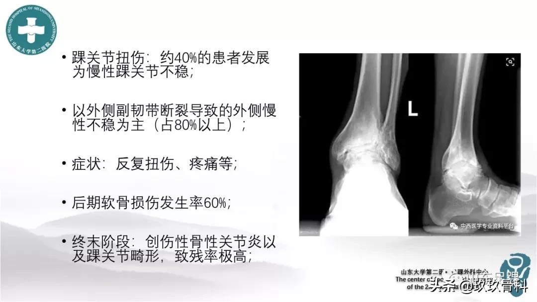 慢性踝关节不稳的训练方法,踝关节镜治疗踝关节不稳