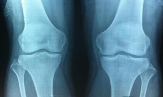 孩子怎么能长高的食谱,孩子补钙长高的营养汤