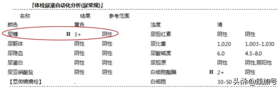读懂体检单丨尿常规检查，能看出来肾好不好？一文教你看懂