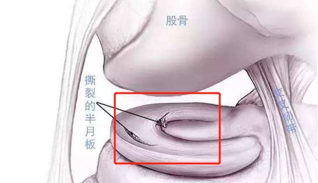 膝盖内侧疼打封闭可以吗,膝盖痛封闭用什么药