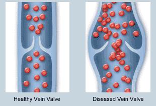 娜扎长筒袜,娜扎瘦腿袜
