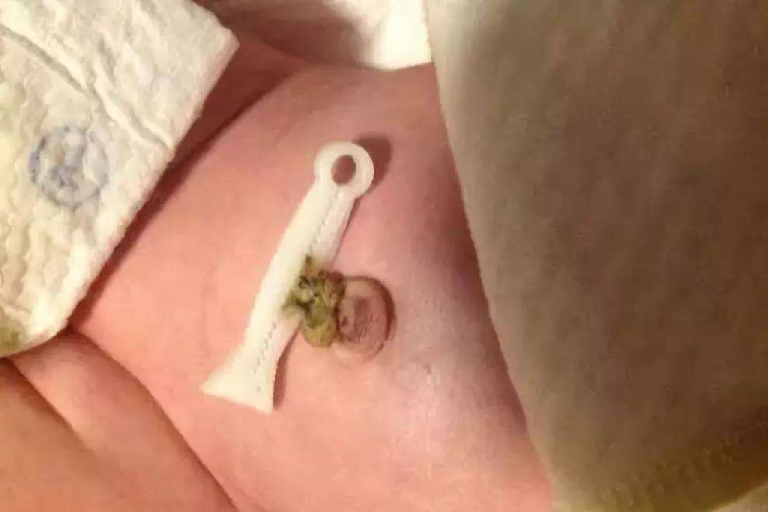 新生儿外出回家正确消毒方法,把新生儿递过来的技巧