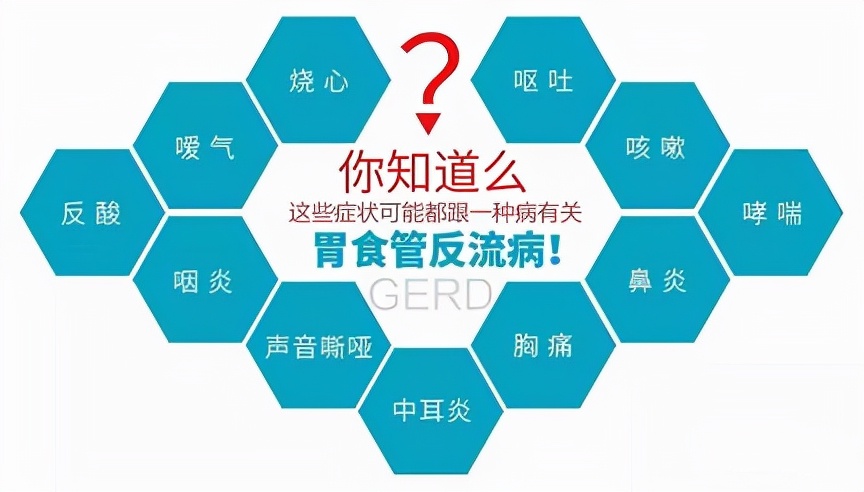 胃食管反流引起咳嗽吃药能缓解吗,胃食管反流咽喉异物感怎么吃药
