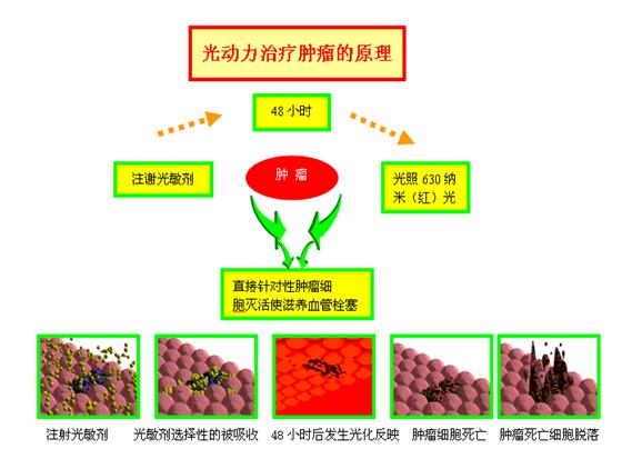 食道癌吞咽困难怎样改善,食道癌吞咽困难的妙方中医