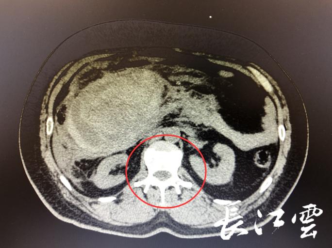 男子大出血民警紧急救援,男子高速突发昏迷民警紧急营救