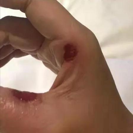 宁夏援鄂医疗队感人视频,襄阳送别援鄂医疗队感动瞬间