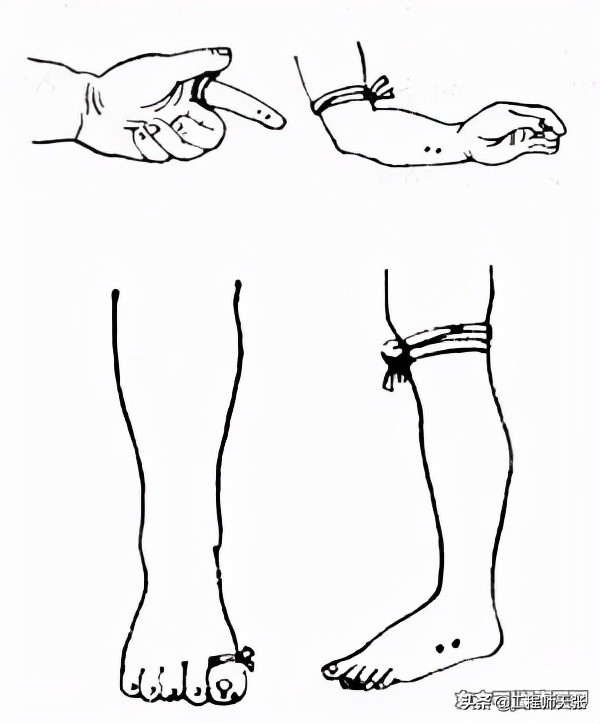 浙江男子走夜路被剧毒蛇咬，成功自救！做法实用，比教科书还经典