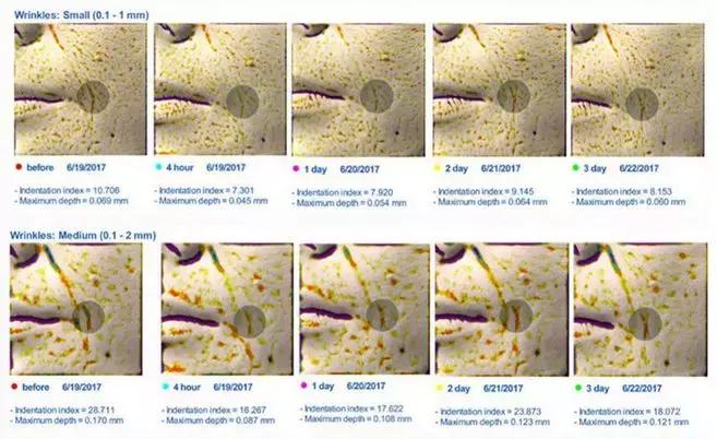 有了前法国第一夫人的百元“黑科技”眼霜，我把3000块眼霜扔了！