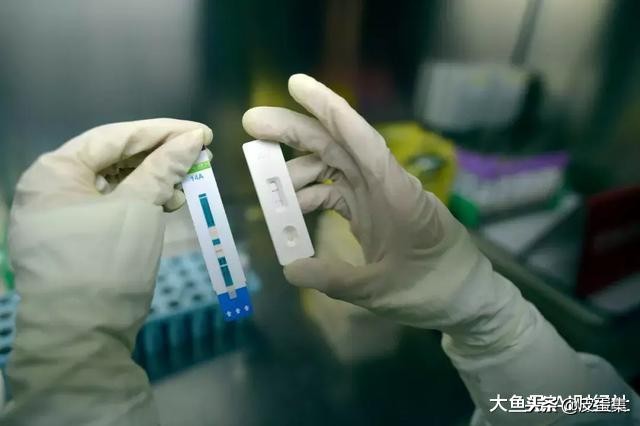 艾滋试纸多少钱一支,艾滋试纸多少钱
