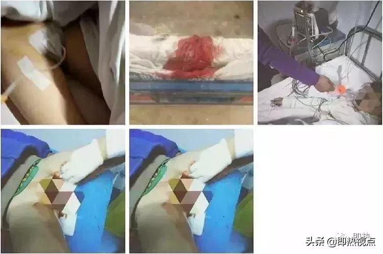 小女孩被捅4000多刀事件,小女孩被捅伤事件