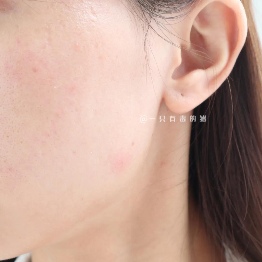 大油田收缩毛孔爽肤水,男士大油田爽肤水