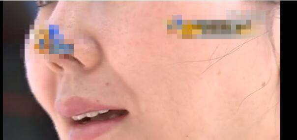 妻子整容变丑,妻子整容变成绝世美人