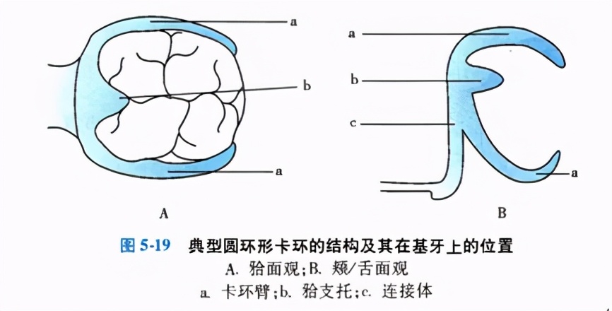 牙列缺损的可摘局部义齿修复题库,牙科美学修复精讲