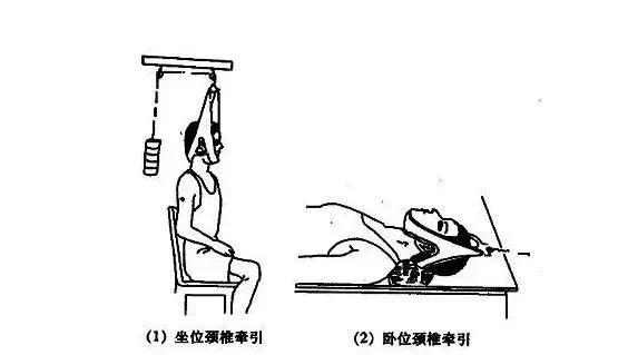 低头颈椎疼头晕如何缓解,科普头晕是怎么回事