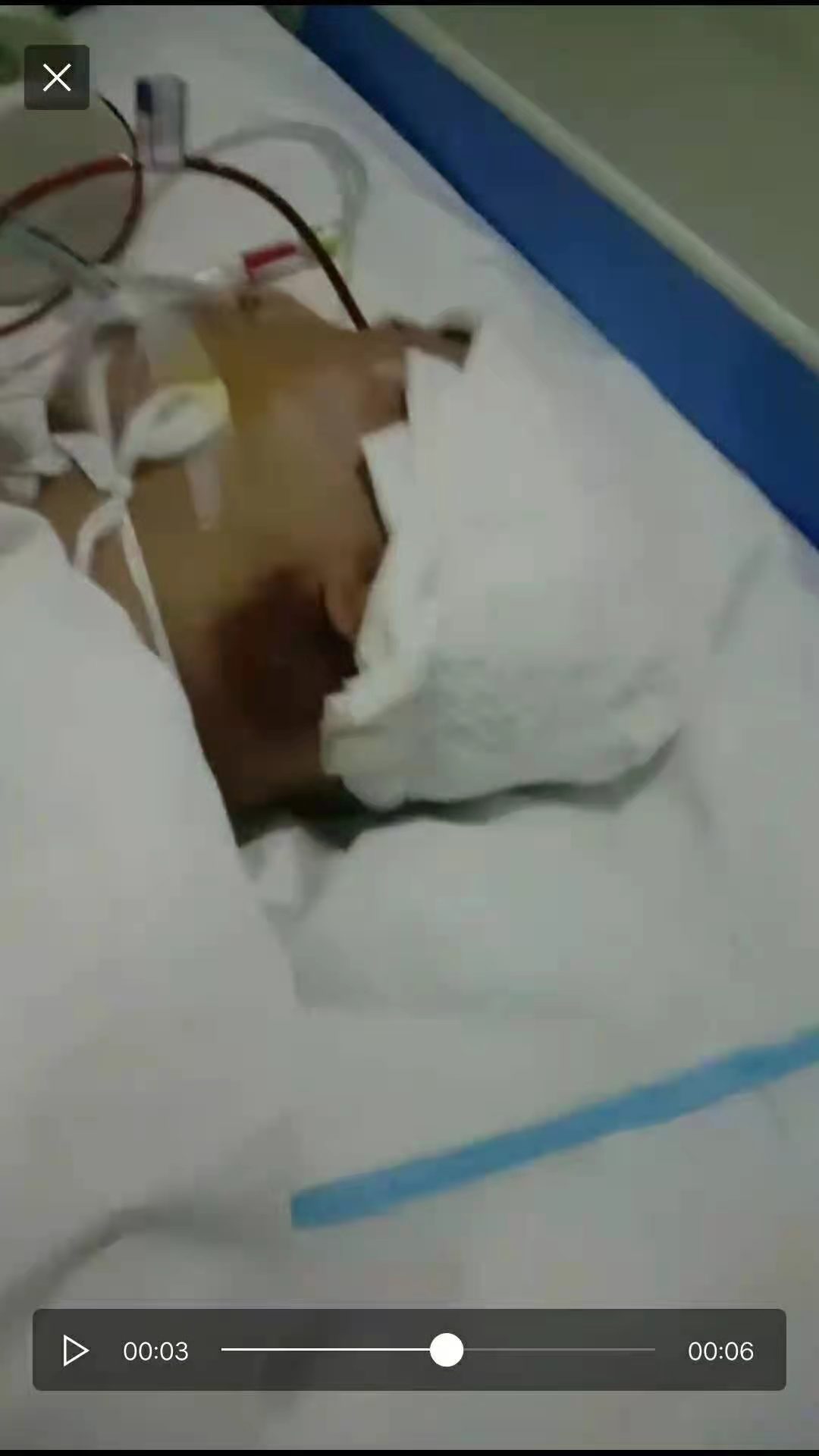 男子在看守所被打,男子看守所被打瘫痪