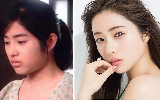 不整容普通女生怎么实现逆袭变美,不整容怎样变好看