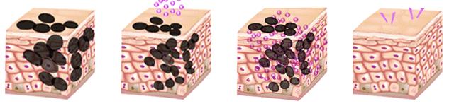 最近流行的面膜是哪个,最近很火的面膜到底怎么样