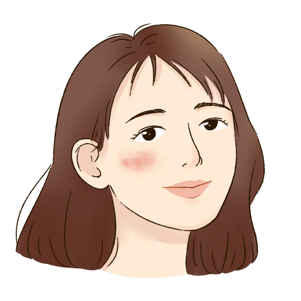 教我们如何淡斑祛斑,如何自己祛斑淡斑